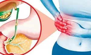 Деформація жовчного міхура причини, симптоми, лікування, у дітей (лікування) Деформація жовчного міхура причини, симптоми, лікування, у дітей