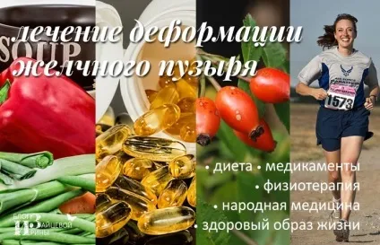 Деформація жовчного міхура, блог Ірини Зайцевої (перегину жовчного міхура) Деформація жовчного міхура, блог Ірини Зайцевої