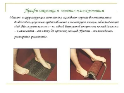 деформація стопи