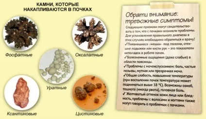 Діатез у дітей симптоми і лікування профілактика фото і дорослих (фото) Діатез у дітей симптоми і лікування профілактика фото і дорослих