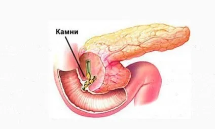Діатез у дітей симптоми і лікування профілактика фото і дорослих (діатез) Діатез у дітей симптоми і лікування профілактика фото і дорослих