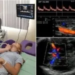 Дуплексне сканування брахіоцефальних артерій розшифровка, показання (дуплексне) Дуплексне сканування брахіоцефальних артерій розшифровка, показання