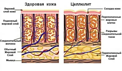 Ефірні масла проти целюліту масаж, обгортання і ванни з ефірними маслами (проти) Ефірні масла проти целюліту масаж, обгортання і ванни з ефірними маслами