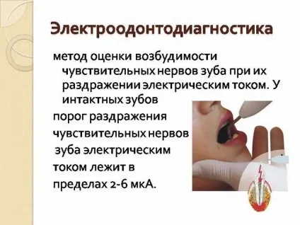 Електородонтодіагностика (ЕОД) в стоматології показники Електроодонтометрія (ЕОД) Електородонтодіагностика (ЕОД) в стоматології показники Електроодонтометрія
