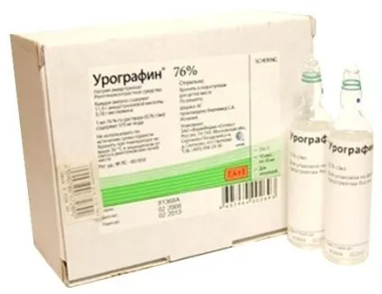 Екскреторна урографія нирок, сечоводів і сечового музиря - причини, симптоми і лікування (сечоводів) Екскреторна урографія нирок, сечоводів і сечового музиря - причини, симптоми і лікування