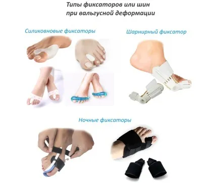 Фіксатор для кісточки на нозі огляд видів і способів застосування (кісточки) Фіксатор для кісточки на нозі огляд видів і способів застосування