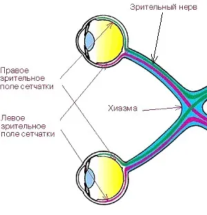 Геміанопсія (гомонимная, гетеронімная, битемпоральная) симптоми, лікування (гемианопсия) Геміанопсія (гомонимная, гетеронімная, битемпоральная) симптоми, лікування