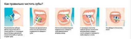 Гнилі зуби причини, лікування і профілактика (причини) Гнилі зуби причини, лікування і профілактика