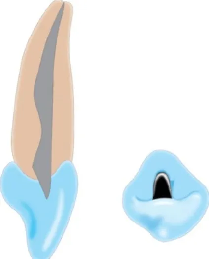 Глава 9 ендодонтія
