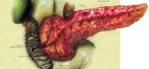 Як болить підшлункова залоза (заліза) Як болить підшлункова залоза