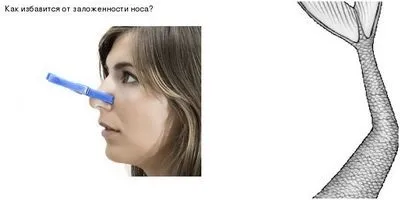 Як позбутися від закладеності вуха