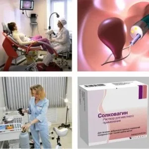 Як лікувати поліпи матки народні способи