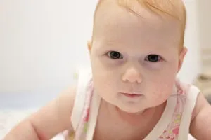 Як впоратися з молочницею у грудних дітей симптоми, лікування і профілактика (лікування) Як впоратися з молочницею у грудних дітей симптоми, лікування і профілактика