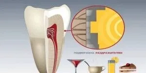Як вбити нерв в зубі будинку народними засобами (нерв) Як вбити нерв в зубі будинку народними засобами