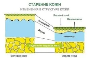 Як прибрати зморшки на лобі - ефективні методи омолодження (зморшки) Як прибрати зморшки на лобі - ефективні методи омолодження