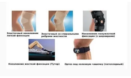 Як вибрати ортопедичні наколінники при артрозі колінного суглоба