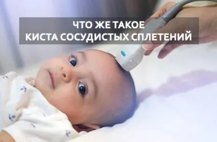 Кісти судинних сплетінь головного мозку у плода - що це (мозку) Кісти судинних сплетінь головного мозку у плода - що це