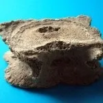 Лікування грижі Шморля - гімнастика, масаж, операція (грижі) Лікування грижі Шморля - гімнастика, масаж, операція