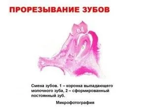 Лізуть зуби як допомогти дитині (зуби) Лізуть зуби як допомогти дитині