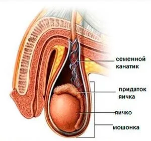 лікування сперматоцеле
