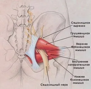 Лікування синдрому грушоподібної м'язи як зняти спазм, особливості лікування в домашніх умовах (грушоподібної) Лікування синдрому грушоподібної м'язи як зняти спазм, особливості лікування в домашніх умовах
