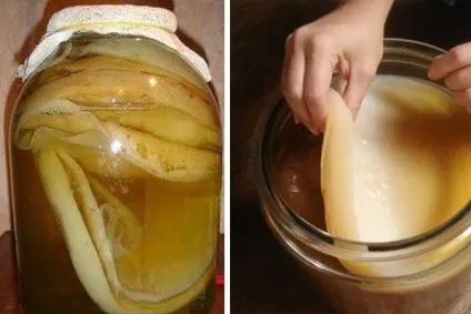 Лікування захворювань фікусом, народні способи і рецепти (лікування) Лікування захворювань фікусом, народні способи і рецепти
