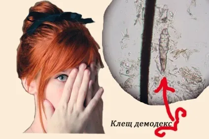 Лікування захворювань фікусом, народні способи і рецепти (рецепти) Лікування захворювань фікусом, народні способи і рецепти