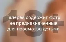 Шрам після кесаревого розтину фото, способи видалення - My Life кесаревого