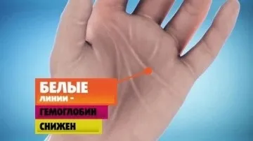 мікроелемент залізо