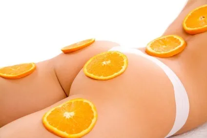 Міфи і факти про целюліт