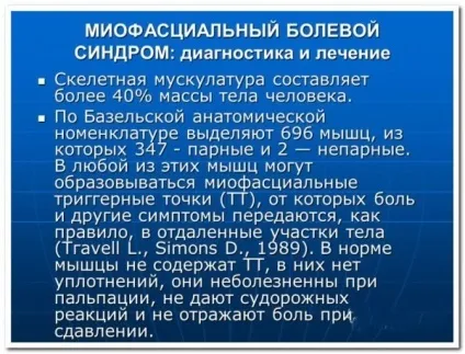 Міофасциальний больовий синдром - джерело хронічного болю (больовий) Міофасциальний больовий синдром - джерело хронічного болю