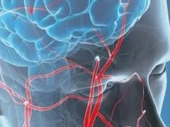 Мрт з контрастом і без, в чому різниця, особливості проходження процедури