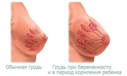 Набухання молочних залоз причини, чому набухла і збільшилася груди, лікування (набухання) Набухання молочних залоз причини, чому набухла і збільшилася груди, лікування