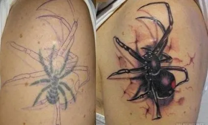 Чи можна робити тату на родимках (tatoo) - якщо багато, поверх