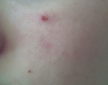 Мій відгук про тональному кремі la roche-posay toleriane teint відгуки