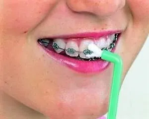 Ортодонтична щітка зубна для брекетів oral b як чистити, купити, ціна (oral) Ортодонтична щітка зубна для брекетів oral b як чистити, купити, ціна