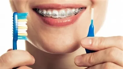 Ортодонтична щітка зубна для брекетів oral b як чистити, купити, ціна (брекетів) Ортодонтична щітка зубна для брекетів oral b як чистити, купити, ціна
