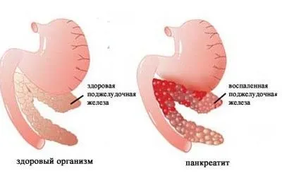 Передозування медом симптоми, наслідки
