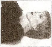 Пластика особи без скальпеля, Керол Мадджіо