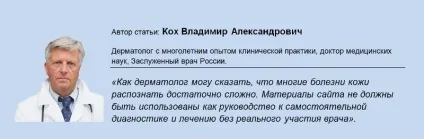 Чому свербить мочка вуха причини