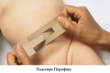 Пластир від пупкової грижі для новонароджених види, як використовувати (новонароджених) Пластир від пупкової грижі для новонароджених види, як використовувати
