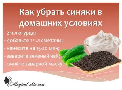 Чому так важко проходять синці на тілі (чому довго проходить синяк тіло півроку слід) Чому так важко проходять синці на тілі