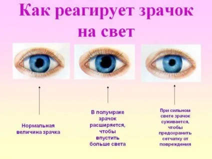 Чому зіниці різного розміру (анізокорія) причини, симптоми, лікування у дорослого і дитини, (розміру) Чому зіниці різного розміру (анізокорія) причини, симптоми, лікування у дорослого і дитини,