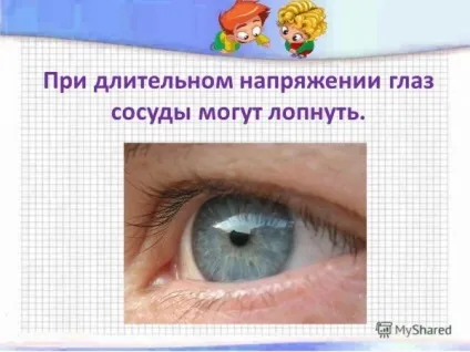 Чому лопаються судини в очах що робити, причини, ніж лікувати, якщо у дорослого і дитини (судини) Чому лопаються судини в очах що робити, причини, ніж лікувати, якщо у дорослого і дитини