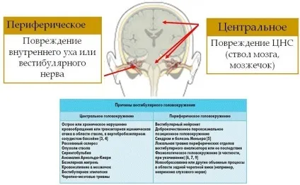Постійно крутиться голова що це може бути, причини у жінок, літніх, чоловіків