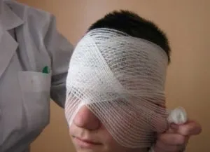 Пов'язка на око
