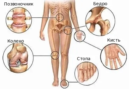 Правильне харчування і дієта при хрускіт в суглобах (хрускіт) Правильне харчування і дієта при хрускіт в суглобах