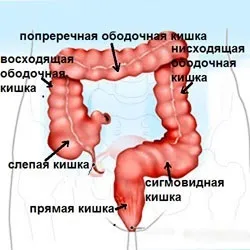 Ознаки коліту болю в животі, діарея, порушення стільця (лікування) Ознаки коліту болю в животі, діарея, порушення стільця