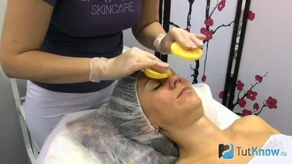 Процедура жовтого пілінгу