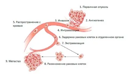 Рак мозку - скільки з них живуть (всіх приписів лікаря) Рак мозку - скільки з них живуть